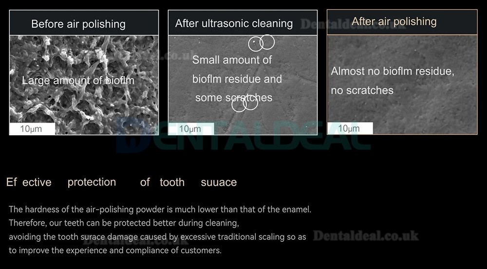 Woodpecker AP-H Plus Dental Air Polisher Supragingival / Subgingival Handpiece