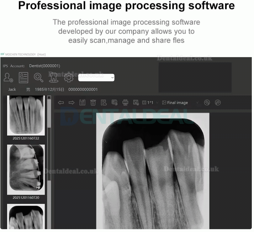 Handy IPS3 Dental Digital X-ray PSP Scanner Phosphor Plate Scanner