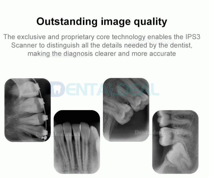 Handy IPS3 Dental Digital X-ray PSP Scanner Phosphor Plate Scanner