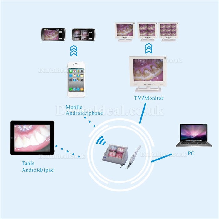 Dental Wired WI-FI Intraoral Camera CF-988A with 8 Inch LCD Minotor M-868 Dental Wired WI-FI Intraoral Camera CF-988A with 8 Inch LCD Minotor M-868