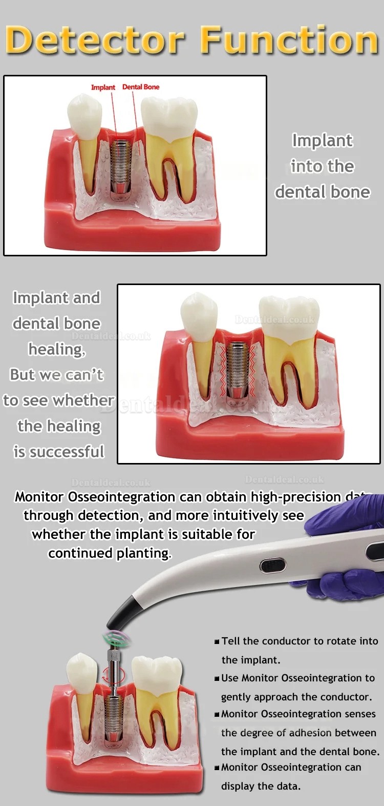 Handheld Dental Implant Stability Monitor Implant Stability Measuring Meter ISQ Tester