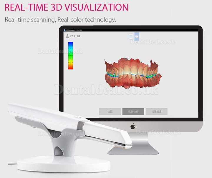 Runyes 3DS Dental 3D Digital Intraoral Scanner Powderless Real Color Scanning Runyes 3DS Dental 3D Digital Intraoral Scanner Powderless Real Color Scanning