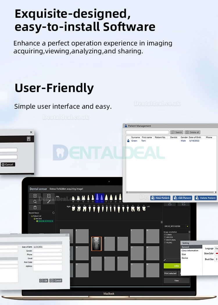 Dental Intraoral RVG Sensor Digital X-Ray Sensor Imaging System S1/S2