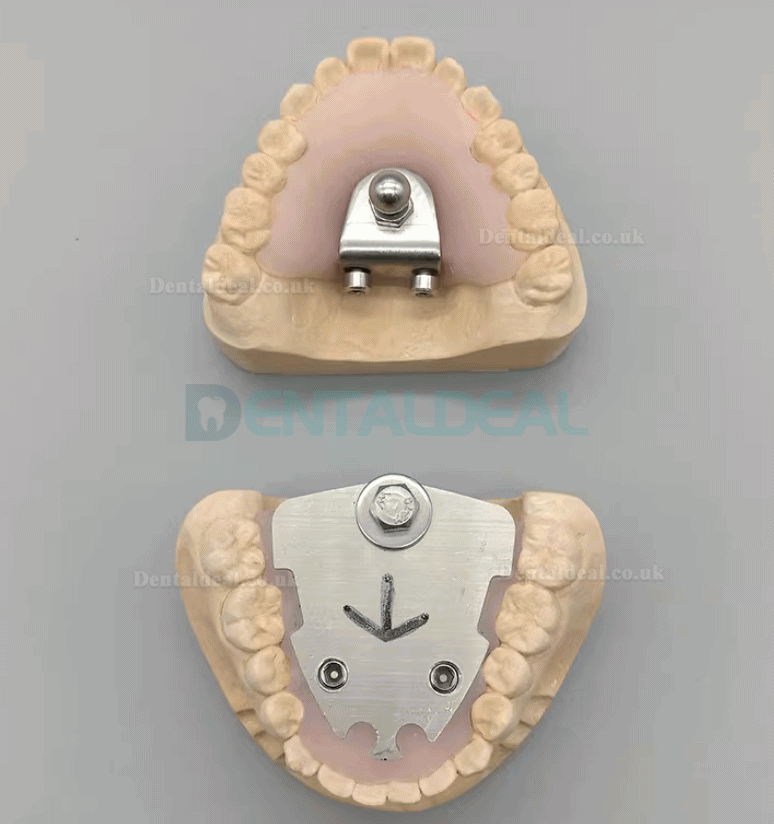 Dental Gothic Arch Tracer for Vertical Centric Recording