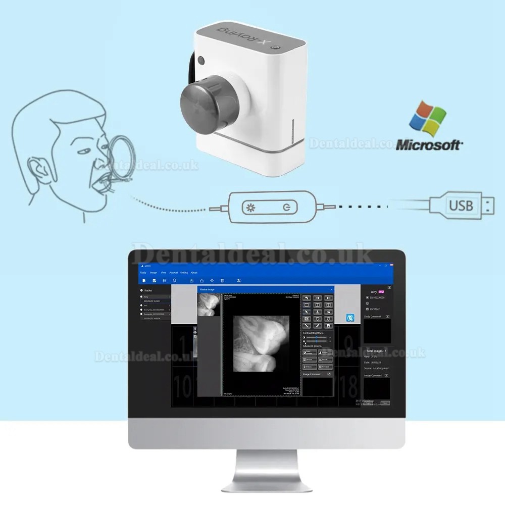 Buy Dental Digital X-Ray Sensor RVG Dental Intraoral Imaging System ...
